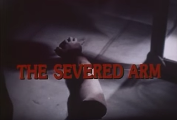 THE SEVERED ARM Free to watch online